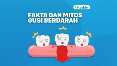 Fakta Medis Seputar Gusi Berdarah: Memahami Lebih Dalam Kondisi yang Sering Diabaikan