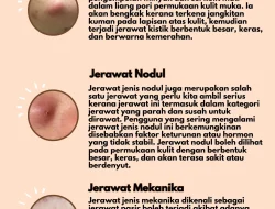 Memahami Perbedaan Jerawat Ringan dan Serius: Panduan Lengkap untuk Kulit Sehat