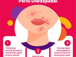 Tanda Awal Kulit Gatal yang Perlu Diwaspadai: Panduan Lengkap untuk Kesehatan Kulit Anda