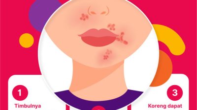 Tanda Awal Kulit Gatal yang Perlu Diwaspadai: Panduan Lengkap untuk Kesehatan Kulit Anda